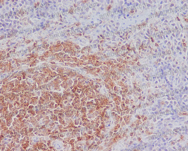 Anti-INPP5D/SHIP Antibody (R1A67)