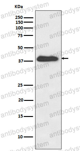 Anti-NHEJ1 Antibody (R2M41)