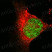 Anti-KAT8 Antibody (R3Z11)