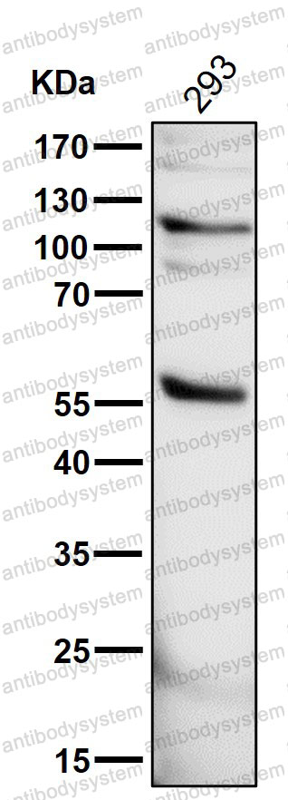 Anti-EGLN1 Antibody (R2M43)
