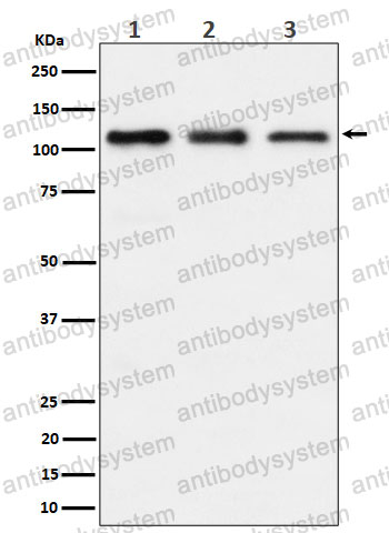 Anti-TAOK1 Antibody (R2M44)