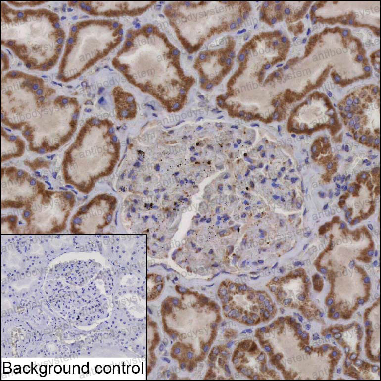 Anti-ACAD9 Antibody (R3Z14)