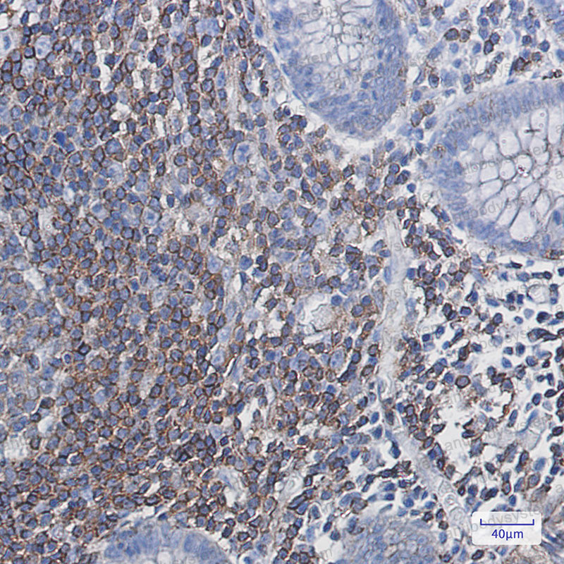 Anti-EGLN3 Antibody (R2M51)
