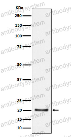Anti-COPS8 Antibody (R2M52)