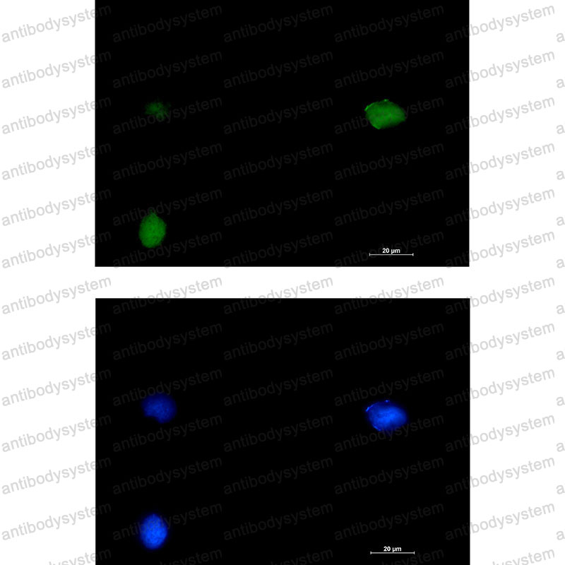 Anti-SMARCC1 Antibody (R2M57)