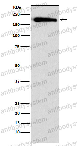 Anti-SMARCC1/BAF155 Antibody (R2M56)