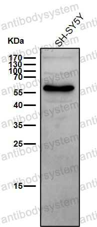 Anti-TCF7L1/TCF3 Antibody (R1B21)