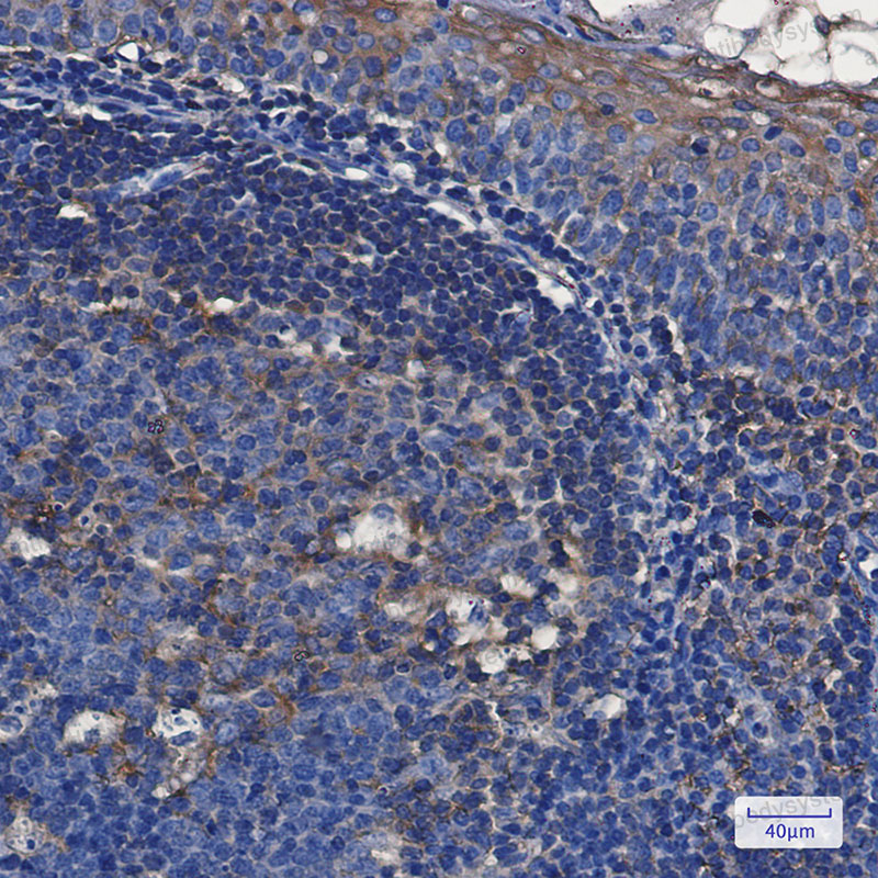Anti-TFG Antibody (R2M60)