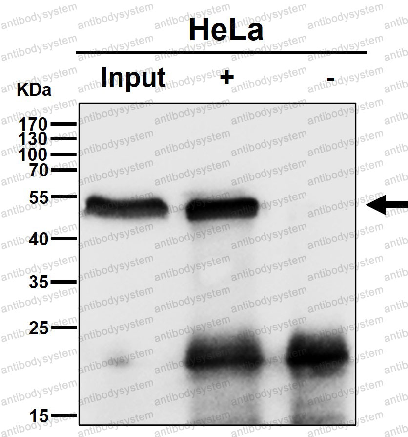 Anti-TFG Antibody (R2M58)