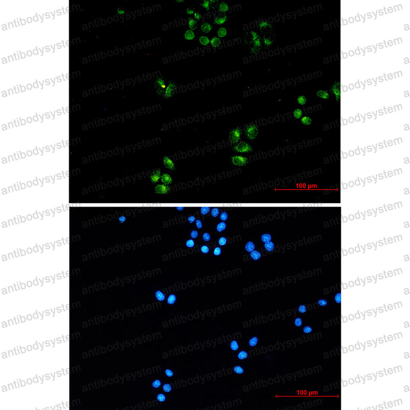 Anti-TFG Antibody (R2M59)