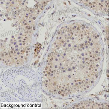 Anti-TRAIP Antibody (R3Z18)