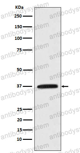 Anti-KLK5 Antibody (R2M61)