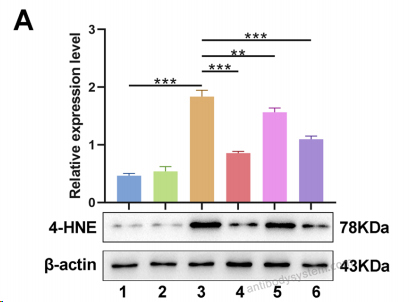 Western Blot for Anti-4R-HNE/4-HNE Antibody (R310) ?>