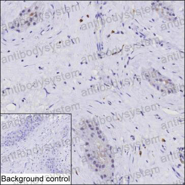 Anti-RNF6 Antibody (R3Z21)
