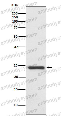 Anti-HSPB8 Antibody (R2M63)