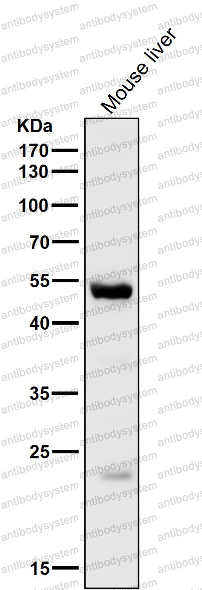 Anti-RIOX2 Antibody (R2M66)