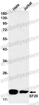 Anti-MYDGF Antibody (R2M67)