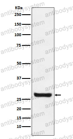 Anti-SPRY4 Antibody (R2M68)