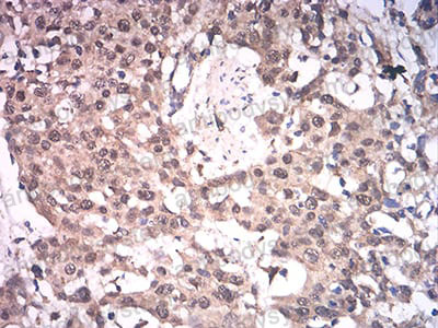 Anti-ASH2L Antibody (R3Z25)