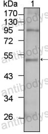 Anti-TBX5 Antibody (R3Z26)