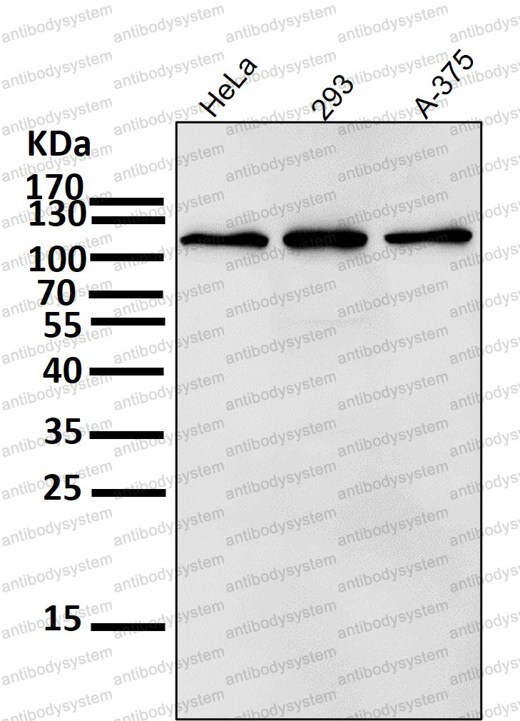 Anti-RNF20 Antibody (R1A13)