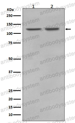 Anti-RNF20 Antibody (R1A32)