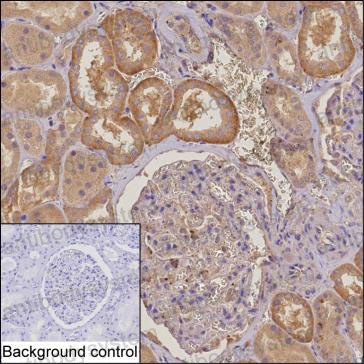 Anti-PIKFYVE Antibody (R3Z30)