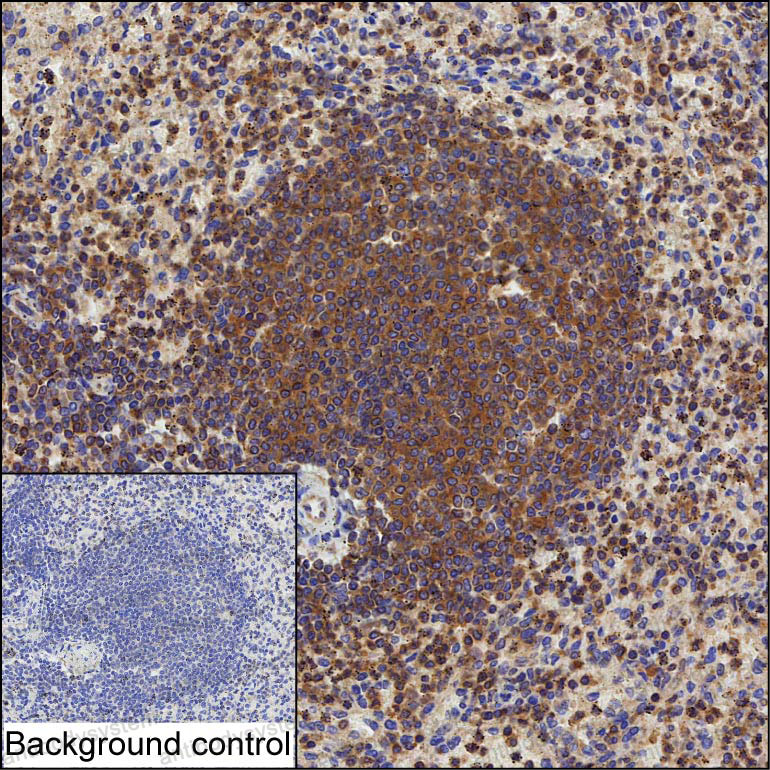 Anti-ARHGEF1 Antibody (R3Z31)