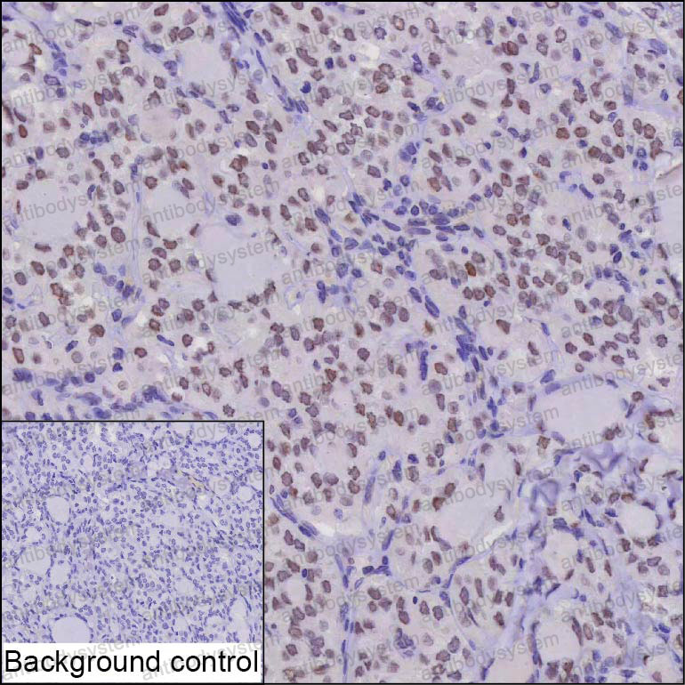 Anti-MACROH2A2 Antibody (R3Z35)