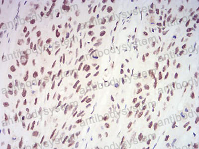 Anti-XRN2 Antibody (R3Z37)