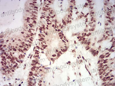 Anti-XRN2 Antibody (R3Z38)
