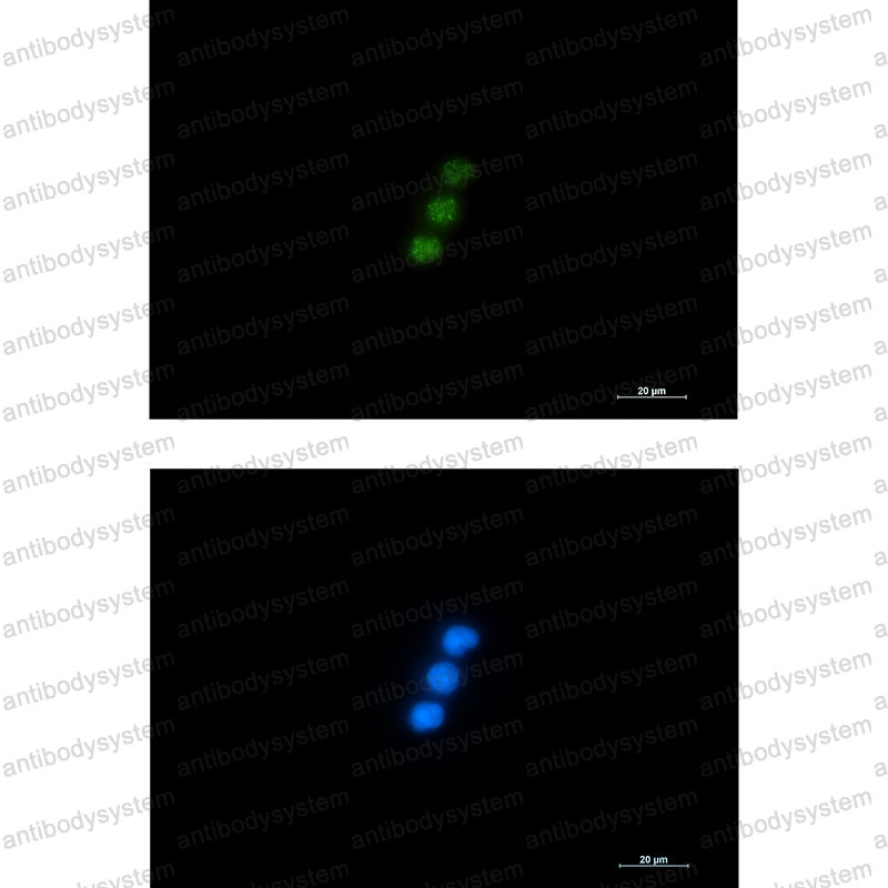 Anti-NXF1 Antibody (R2N06)