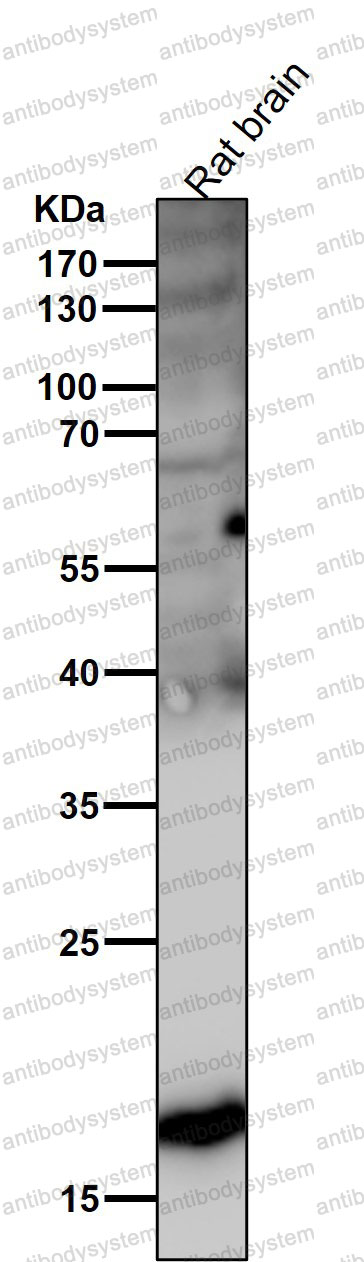 Anti-HES5 Antibody (R2N07)