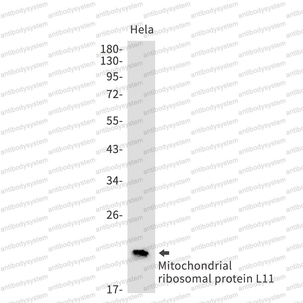 Anti-MRPL11 Antibody (R2N09)