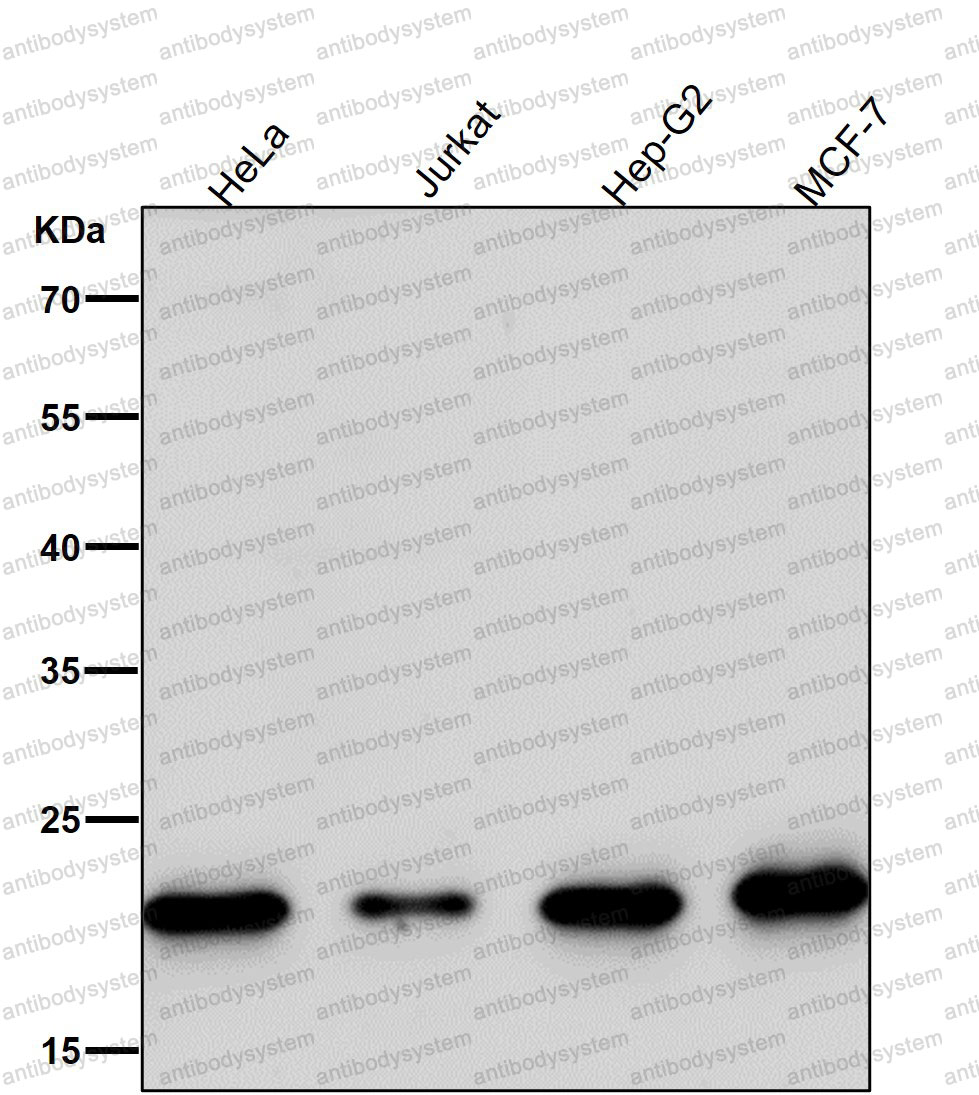 Anti-MRPL11 Antibody (R2N08)