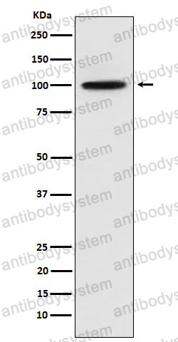 Anti-CTNNA3 Antibody (R2N11)