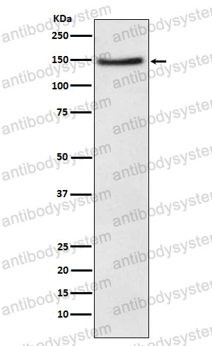 Anti-NPC1L1 Antibody (R2N12)