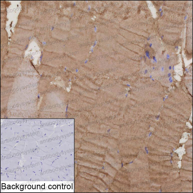 Anti-METRNL/Subfatin Antibody (R3Z43)