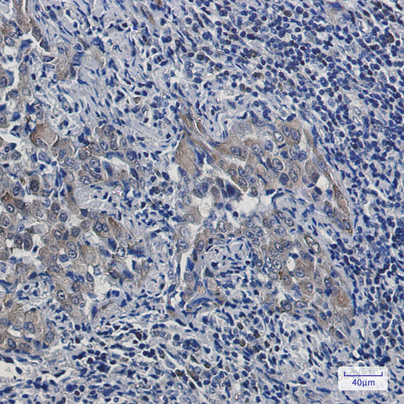 Anti-ARTN/Artemin Antibody (R2N13)