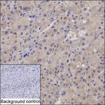 Anti-VASH2/Vasohibin-2 Antibody (R3Z45)