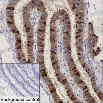 Anti-AGR3 Antibody (R3Z47)