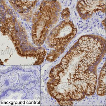Anti-AGR3 Antibody (R3Z48)