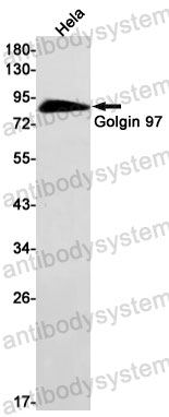 Anti-GOLGA1 Antibody (R2N18)