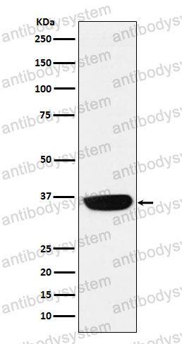 Anti-PHOX2B Antibody (R2N19)