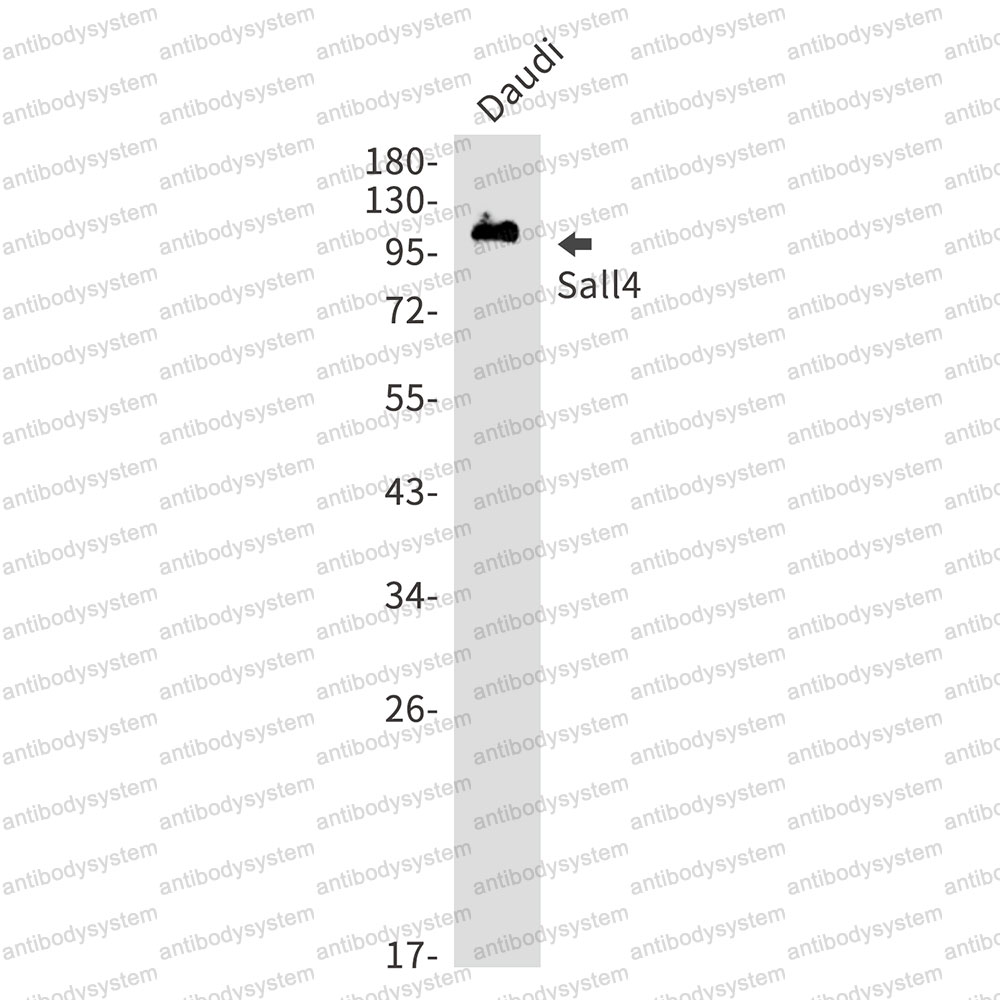 Anti-SALL4 Antibody (R2N20)