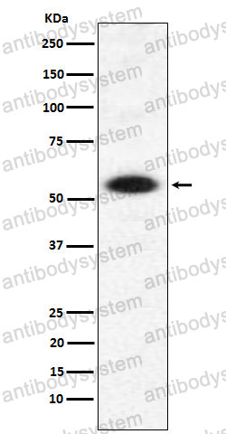 Anti-DMAP1 Antibody (R2N21)