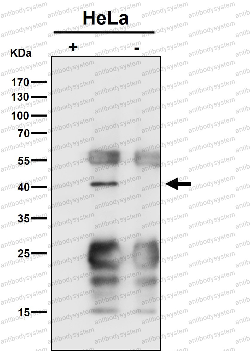 Anti-EXOG Antibody (R2N22)