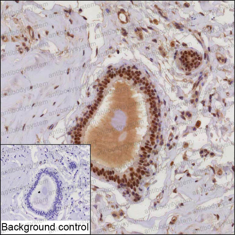 Anti-TRPS1 Antibody (R3Z58)