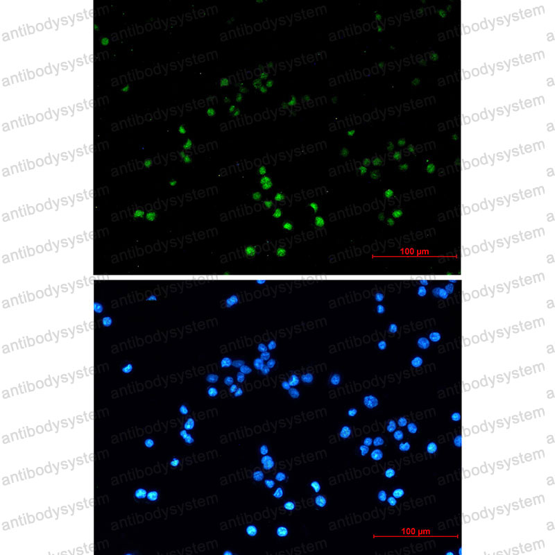 Anti-ZHX2 Antibody (R2N25)