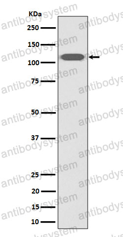 Anti-ZHX2 Antibody (R2N24)